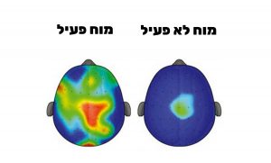 שיפור תפקוד המוח